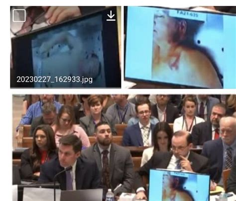 autopsy photos of maggie murdaugh|Alex Murdaugh trial: Autopsy photos shown, and witnesses paint。